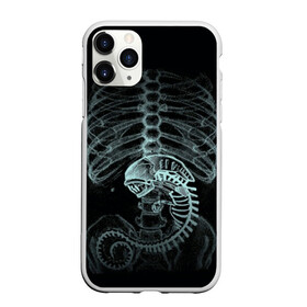 Чехол для iPhone 11 Pro Max матовый с принтом Чужой на Рентгене в Санкт-Петербурге, Силикон |  | alien | больница | больной | внутренний мир | врач | клиника | кости | пациент | ребра | рентген | скелет | снимок | хищник