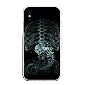 Чехол для iPhone XS Max матовый с принтом Чужой на Рентгене в Санкт-Петербурге, Силикон | Область печати: задняя сторона чехла, без боковых панелей | alien | больница | больной | внутренний мир | врач | клиника | кости | пациент | ребра | рентген | скелет | снимок | хищник
