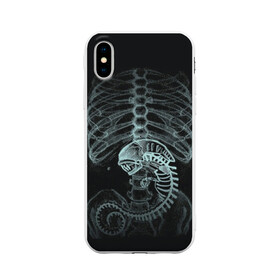 Чехол для iPhone X матовый с принтом Чужой на Рентгене в Санкт-Петербурге, Силикон | Печать на задней стороне чехла, без боковой панели | alien | больница | больной | внутренний мир | врач | клиника | кости | пациент | ребра | рентген | скелет | снимок | хищник