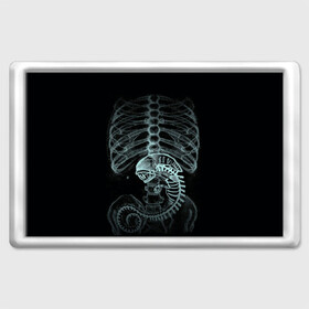 Магнит 45*70 с принтом Чужой на Рентгене  в Санкт-Петербурге, Пластик | Размер: 78*52 мм; Размер печати: 70*45 | Тематика изображения на принте: alien | больница | больной | внутренний мир | врач | клиника | кости | пациент | ребра | рентген | скелет | снимок | хищник